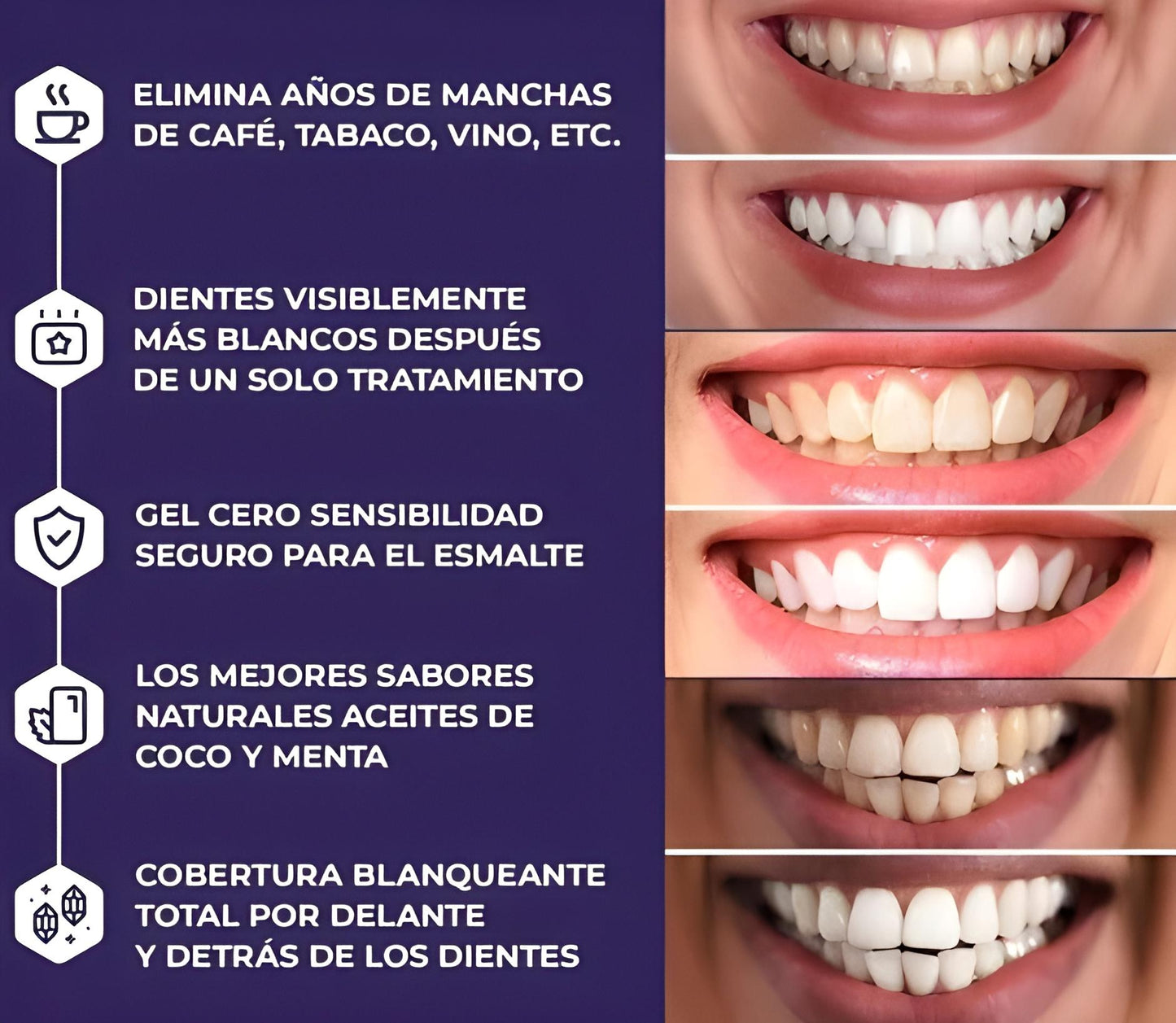 WHITENING STRIPS : Kit profesional de blanqueamiento dental