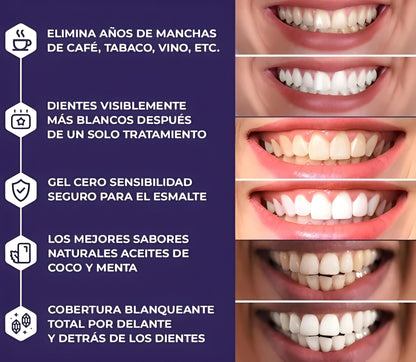 WHITENING STRIPS : Kit profesional de blanqueamiento dental